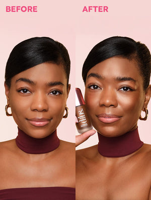 LoveBeam® Perfector